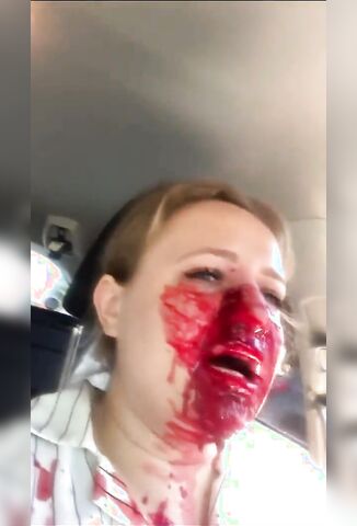 Woman Shot In The Face Freaking Out