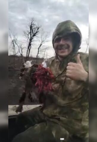 Smiling Russian Soldier Proud Of His Missing Hand