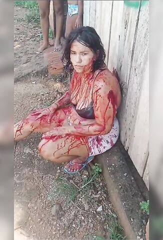 Girl Beaten Badly By Boyfriend Left Bleeding Out On The Street