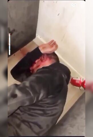 Scottish Scum Stab A Man In His Ass Trying To Get His Bank PIN On SnapChat