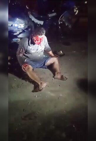 Poor Guys Face Completely Ripped Off In Road Accident