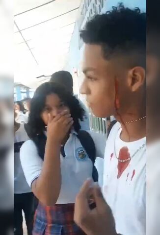 School Kid Slices Another Students Face Wide Open In Front Of Teacher