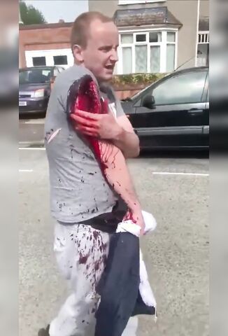 Mans Arm Chopped Up On The Streets Of London