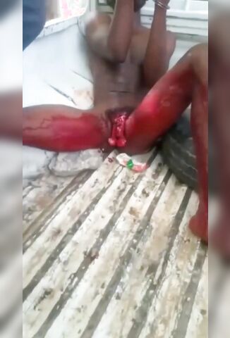Police Arrest A Man With His Dick Sliced off