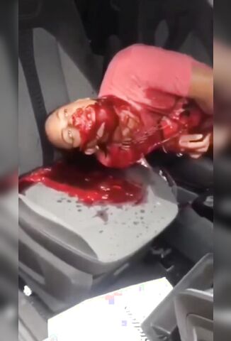 Last Blood Filled Breaths Of Young Man In His Car