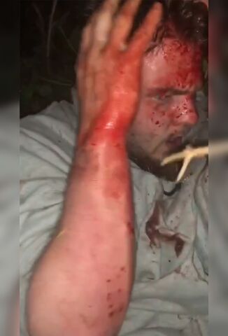 Man Accused Of Being A Pedo Beaten And Stabbed By Black Gangbangers
