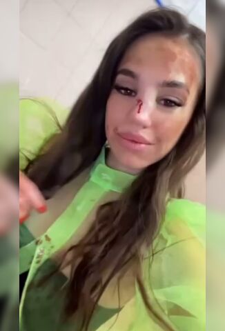 Man Viciously Elbows Girl In The Face First Thing She Does Is Social Media