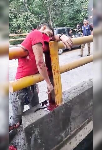 Man Skewered Through His Torso By Guard Rail