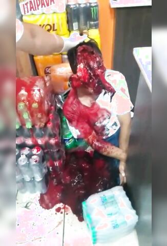 Man With His Face Ripped Off Struggling To Breath Through The Blood