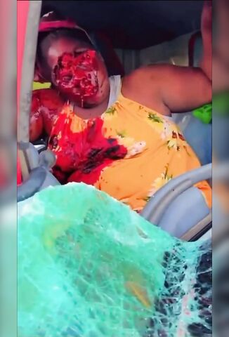 Poor Jamaican Women's Face And Eyes Ripped Off In Traffic Accident