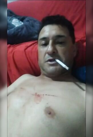 Man With Knife Blade Embedded In His Belly Says A Chilled Goodbye To All