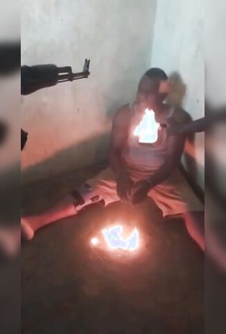 Man In Haiti Tortured With Molten Plastic Turns Into A Singing Banshee