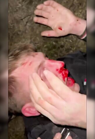 Man Savagely And Brutally Beaten To A Bloody Pulp In Russia