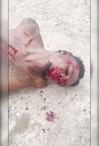 Haiti Gangster Being Tortured With A Macheted Wound On His Leg