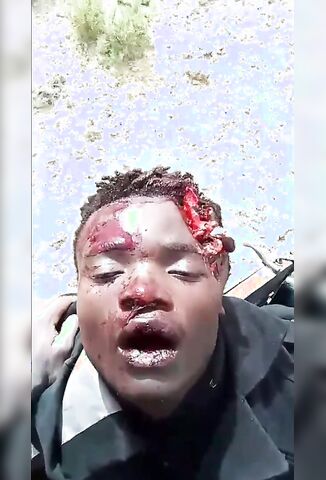 Migrant Shot In The Head By Tunisian National Guard Crossing The Mediterranean Sea