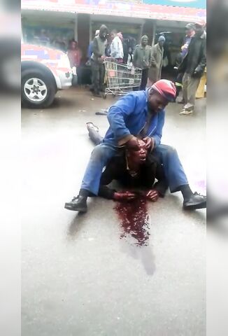 Crazed Man Gouges Out Another Mans Eyes In The Street