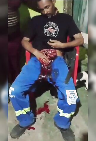 Dog Enjoys Licking Up The Blood From Disembowelled Man