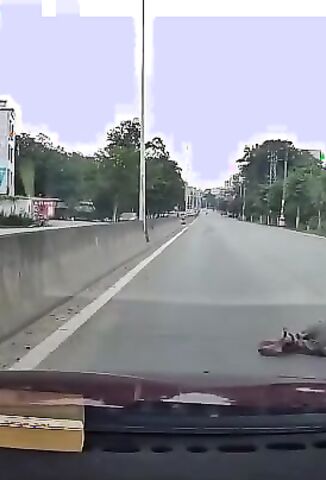 Old Man On A Scooter Suffers Open Leg Fracture Crossing The Road