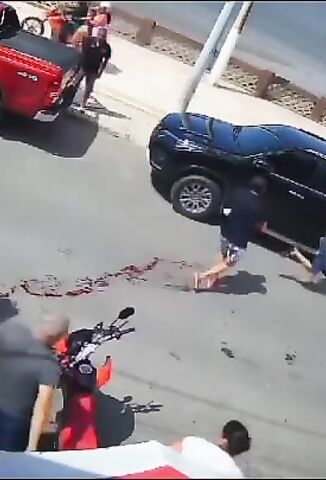 Man Runs From Restaurant Leaking Blood All Over The Street