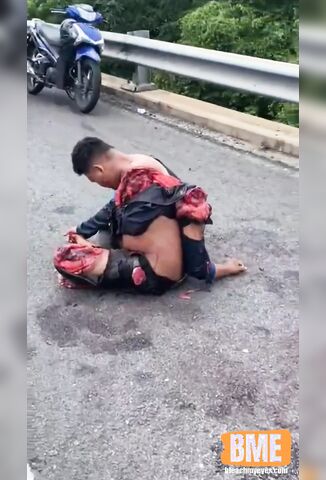Bikers Arm Ripped Off At The Shoulder And Leg Mangled