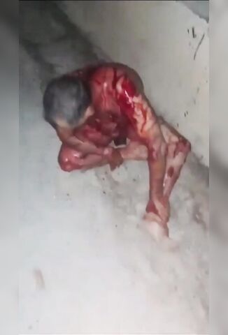 Naked Man Bleeding Out After Being Stabbed 9 Times