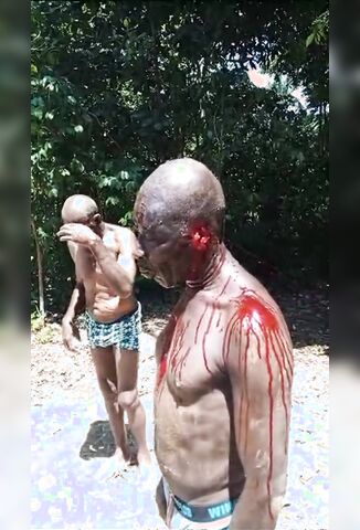 Two Haitian Men Stream Blood As They Are Forced To Eat Their Own Ears