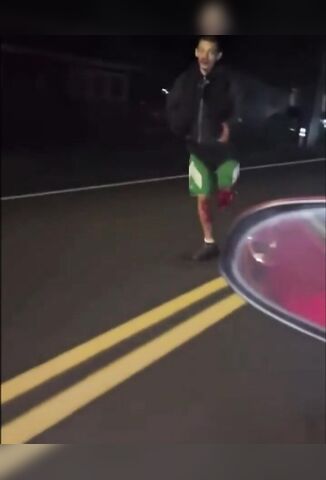 Dude Standing In The Road With His Leg Ripped Off