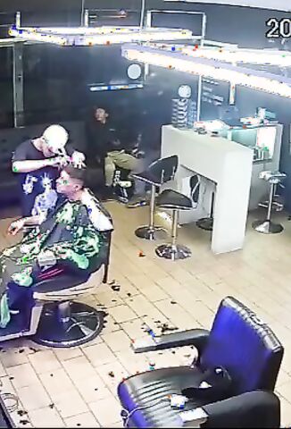 Man Getting A Haircut Ends Up With A Head Cut Instead