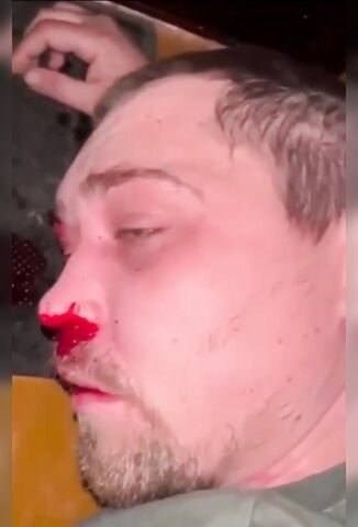 Man Caught Trying Meet Underage Girl Beaten Bloody In Russia