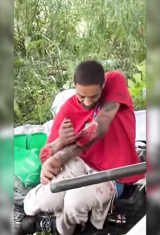 Drug Addicts Tears His Own Flesh From His Arm