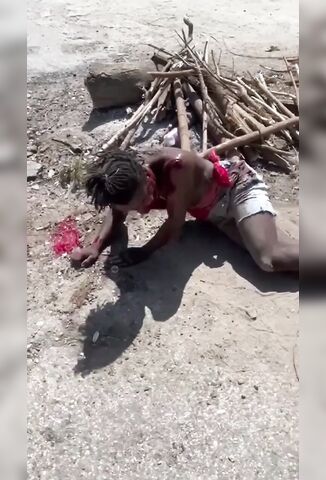 Beaten And Bloody Man Suffers The Horror Of Being Burned Alive