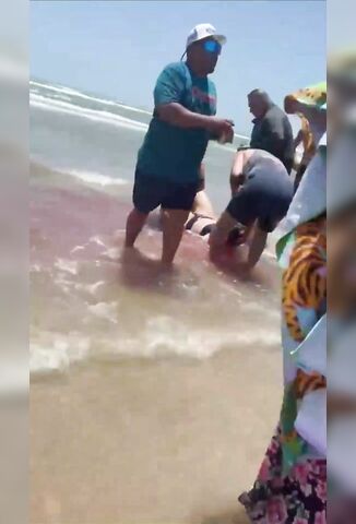 Shark Hangs Around And Gloats Around After Taking Half A Woman's Calf Muscle