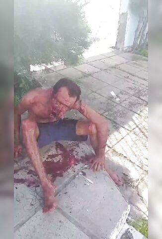 Mans Face Ripped Off From Brutal Animal Attack