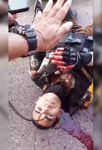 Sad Video - Biker With His Neck Sliced Open Given Last Rights On The Road