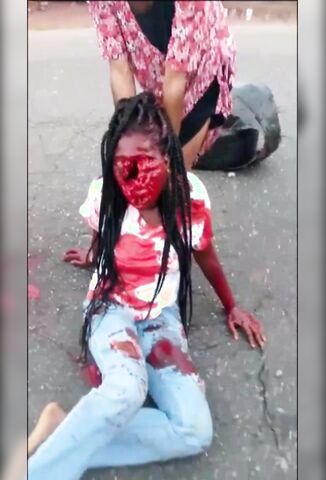 Poor Womans Face Ripped Off In Nigerian Car Wreck