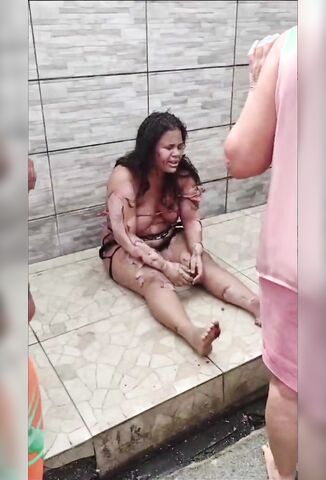 Girls Clothes And Skin Burned Off In Cylinder Explosion