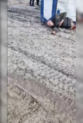 Shipping Container Falls And Removes Mans Lower Limbs