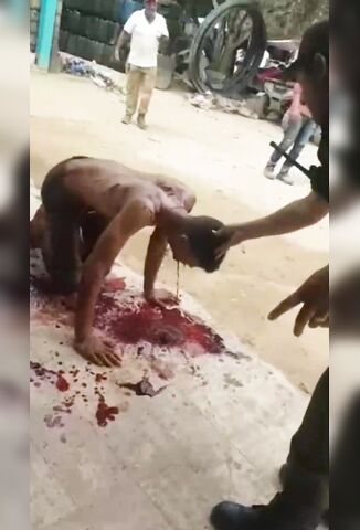 Man With His Throat Cut Leaking Profusely On The Street