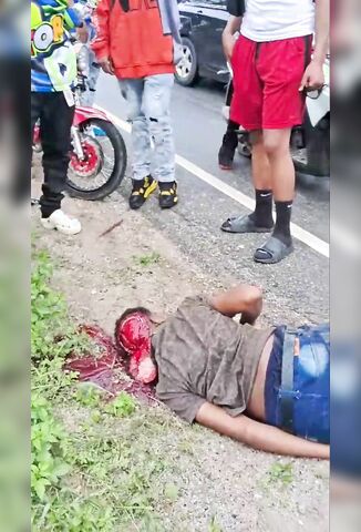 Biker Scalped - Another Reason To Always Wear A Helmet