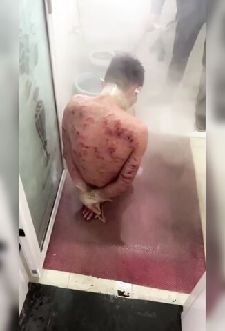 Tortured Man Is Given A Boiling Hot Shower