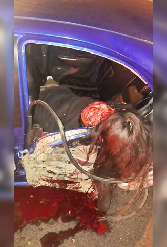 Two Killed One Scalped In High Impact RTA