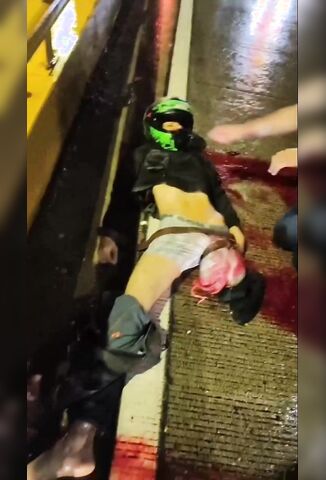 Biker Loses His Leg And Then His Life After Hitting Guard Rail In Wet Weather