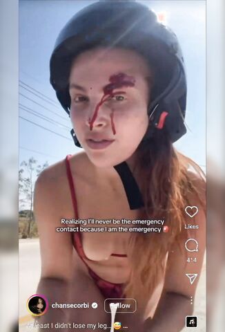 Attention Whore Wants Attention After Crashing Wearing Her Safety Gear