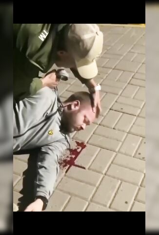 Man Takes A 2 x 4 To The Face Leaving Him Hospitalised With Serious Injury