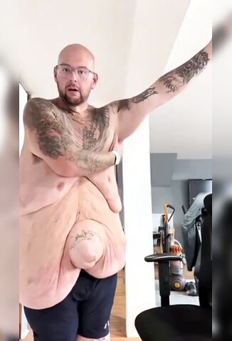 Needs Help With His Skin