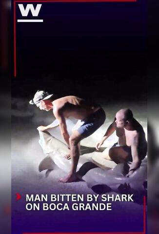 Man Posing For Photo With A Shark Loses His Calf