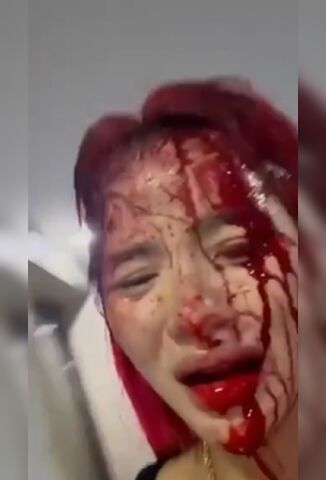 First Thing Gen Zs Do When They Get Assaulted - Make A Tik Tok Of Course