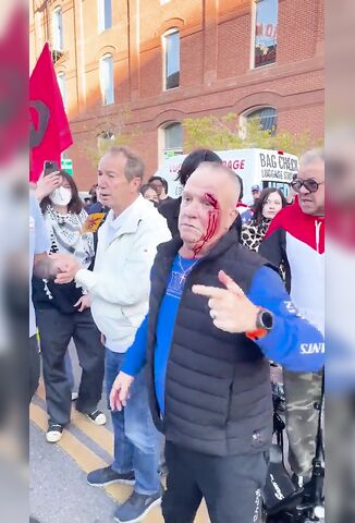 Lets Go ICE God Bless Trump - Ends Up Busted And Leaking At No Kings Protest