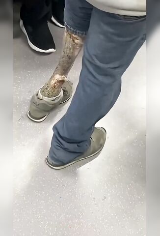 Dude Needs A New Leg