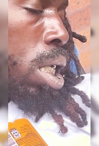 Damn Flies Laying Eggs In Bros Teeth